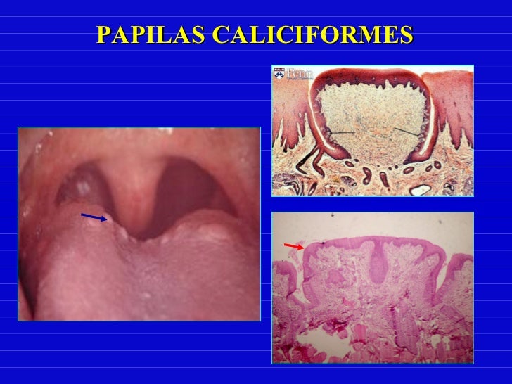 Epitelio Mucosa Oral