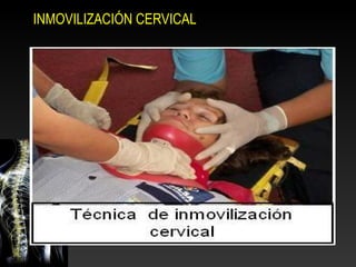 INMOVILIZACIÓN CERVICAL
 