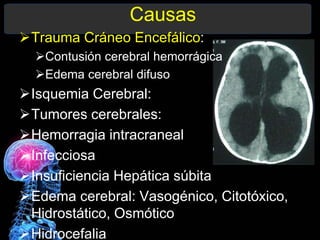 Causas
Trauma Cráneo Encefálico:
Contusión cerebral hemorrágica
Edema cerebral difuso
Isquemia Cerebral:
Tumores cerebrales:
Hemorragia intracraneal
Infecciosa
Insuficiencia Hepática súbita
Edema cerebral: Vasogénico, Citotóxico,
Hidrostático, Osmótico
Hidrocefalia
 