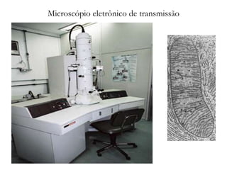Microscópio eletrônico de transmissão
 