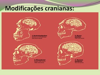 Modificações cranianas:
 