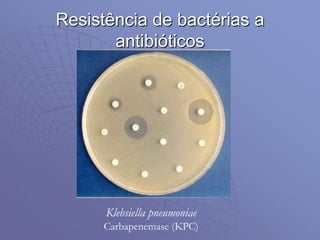 Resistência de bactérias a
antibióticos
Klebsiella pneumoniae
Carbapenemase (KPC)
 