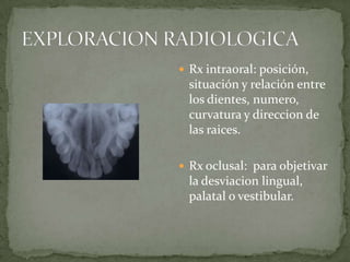  Rx intraoral: posición,

situación y relación entre
los dientes, numero,
curvatura y direccion de
las raices.
 Rx oclusal: para objetivar

la desviacion lingual,
palatal o vestibular.

 