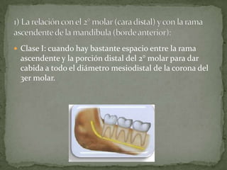  Clase I: cuando hay bastante espacio entre la rama

ascendente y la porción distal del 2° molar para dar
cabida a todo el diámetro mesiodistal de la corona del
3er molar.

 