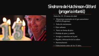 SíndromedeHutchinson-Gilford
(progeriainfantil)
Entre los 18- 24 meses de edad
• Mutaciones puntuales en el gen autosómico...