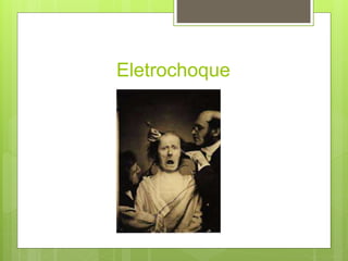 Eletrochoque
 