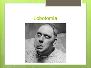 Lobotomia
 