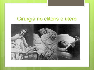 Cirurgia no clitóris e útero
 