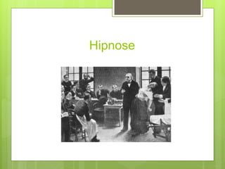 Hipnose
 