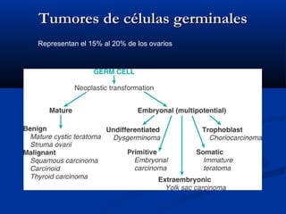 Tumores de células germinales
Representan el 15% al 20% de los ovarios
​

 