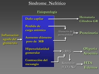 Síndrome Nefrítico
Fisiopatología
Inflamación
aguda del
glomérulo
Daño capilar
Perdida de
carga aniónica
Aumento diámetro
poro de MB
Hipercelularidad
gomerular
Contracción del
mesangio
Hematuria
Cilindros GR
Proteinuria
Retención
H2O e Na+
Oliguria
Azoemia
HTA
Edemas
Alteración de la
permeabilidad
RFG
 