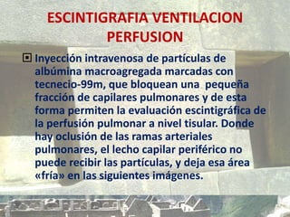 ESCINTIGRAFIA VENTILACION
PERFUSION
 Inyección intravenosa de partículas de
albúmina macroagregada marcadas con
tecnecio-99m, que bloquean una pequeña
fracción de capilares pulmonares y de esta
forma permiten la evaluación escintigráfica de
la perfusión pulmonar a nivel tisular. Donde
hay oclusión de las ramas arteriales
pulmonares, el lecho capilar periférico no
puede recibir las partículas, y deja esa área
«fría» en las siguientes imágenes.
 