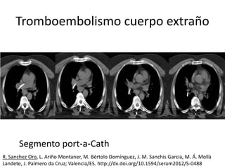 Tromboembolismo Pulmonar. Actualizacion 2020. Catedra Medicina Interna