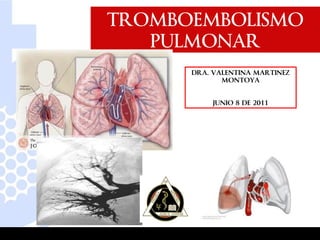 TROMBOEMBOLISMO
 TROMBOEMBOLISMO
    PULMONAR
    PULMONAR
      DRA. VALENTINA MARTINEZ
             MONTOYA


          JUNIO 8 DE 2011
 