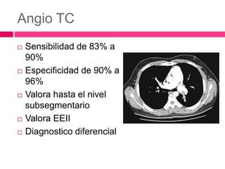 Angio TC
 Sensibilidad de 83% a
90%
 Especificidad de 90% a
96%
 Valora hasta el nivel
subsegmentario
 Valora EEII
 Diagnostico diferencial
 