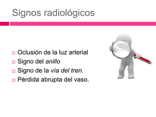 Signos radiológicos
 Oclusión de la luz arterial
 Signo del anillo
 Signo de la vía del tren.
 Pérdida abrupta del vaso.
 