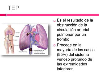 TEP
 Es el resultado de la
obstrucción de la
circulación arterial
pulmonar por un
trombo
 Procede en la
mayoría de los casos
(95%) del sistema
venoso profundo de
las extremidades
inferiores
 