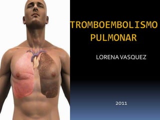 Tromboembolismo Pulmonar LORENA VASQUEZ 2011 