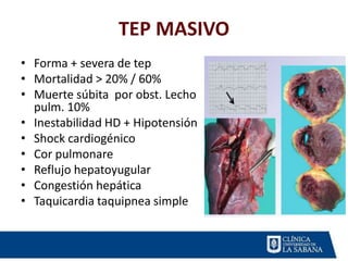 TEP MASIVO
• Forma + severa de tep
• Mortalidad > 20% / 60%
• Muerte súbita por obst. Lecho
pulm. 10%
• Inestabilidad HD + Hipotensión
• Shock cardiogénico
• Cor pulmonare
• Reflujo hepatoyugular
• Congestión hepática
• Taquicardia taquipnea simple
 