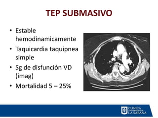 TEP SUBMASIVO
• Estable
hemodinamicamente
• Taquicardia taquipnea
simple
• Sg de disfunción VD
(imag)
• Mortalidad 5 – 25%
 