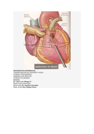 DIAGNOSTICO DIFERENCIAL
TRANSPOSICION DE GRANDES VASOS.
ATRESIA TRICUSPIDICA.
ANOMALIA DE EBSTEIN.
ATRESIA PULMONAR.
Autores:
Dr. José Luís Villegas P
Resid: Curso Intermedio
Resd II año Dr. Aquilino González
Resd. III año Dra. Gladys Perez
 