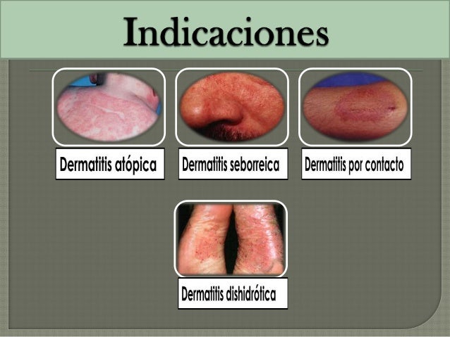 Si ayuda asd a la eccema