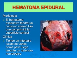 Morfología
 El hematoma
expansivo tendrá un
contorno interno liso
que comprimirá la
superficie cortical
Clínica
 Tienen un intervalo
lucido de varias
horas pero luego
tendrán un deterioro
neurológico
HEMATOMA EPIDURAL
 