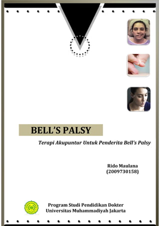 BELL’S PALSY
Terapi Akupuntur Untuk Penderita Bell’s Palsy

Rido Maulana
(2009730158)

Program Studi Pendidikan Dokter
Universitas Muhammadiyah Jakarta

 