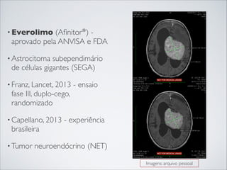 • Everolimo

(Aﬁnitor®) aprovado pela ANVISA e FDA

• Astrocitoma

subependimário
de células gigantes (SEGA)

• Franz, Lancet, 2013

fase III, duplo-cego,
randomizado

• Capellano, 2013

brasileira

• Tumor

- ensaio

- experiência

neuroendócrino (NET)
Imagens: arquivo pessoal

 