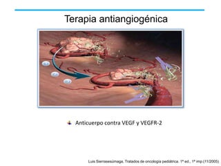 Terapia antiangiogénica

Anticuerpo contra VEGF y VEGFR-2

Luis Sierrasesúmaga, Tratados de oncología pediátrica. 1ª ed., 1ª imp.(11/2005)

 