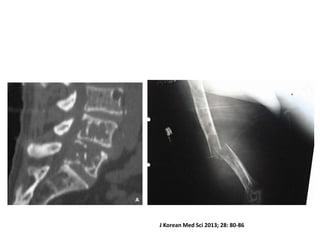 J Korean Med Sci 2013; 28: 80-86

 