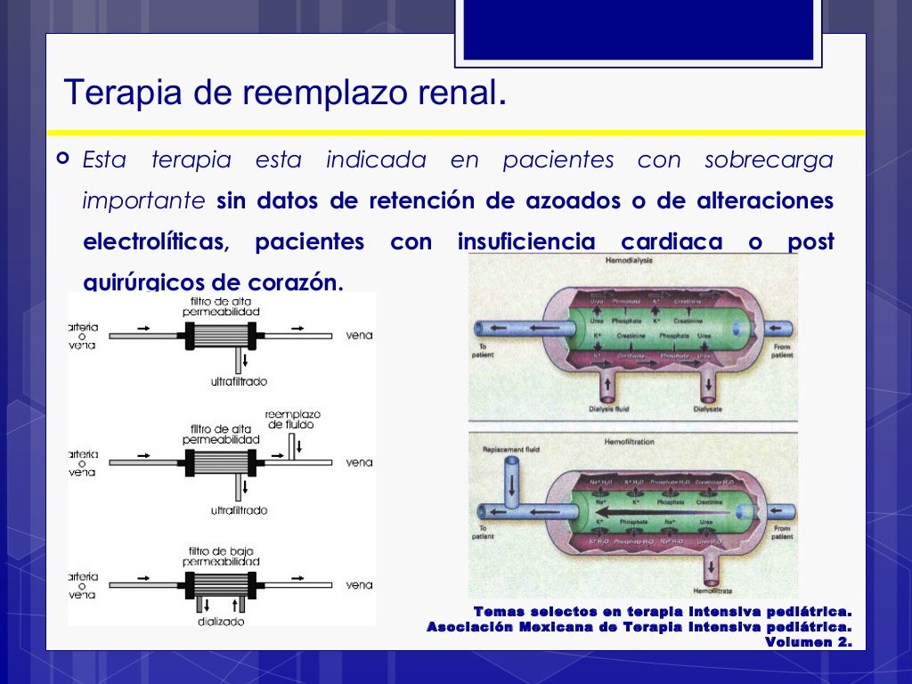 Terapia de reemplazo en Insuficiencia Renal