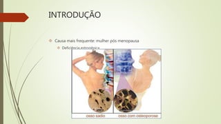 INTRODUÇÃO
 Causa mais frequente: mulher pós menopausa
 Deficiência estrogênica
 