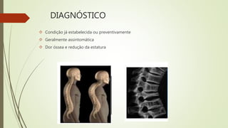 DIAGNÓSTICO
 Condição já estabelecida ou preventivamente
 Geralmente assintomática
 Dor óssea e redução da estatura
 