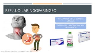 REFLUJO LARINGOFARINGEO
INFLAMACIÓN DE LAS CUERDAS
VOCALES
CAMBIOS EN LA BIOMECÁNICA DE
LA FONACIÓN
Johnson J. Bailey’s Head and Neck Surgery. Lippincott Williams & Wilkins; 2013.
 