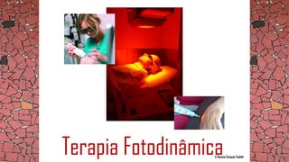 Terapia Fotodinâmica© Renata Campos Cadidé
 