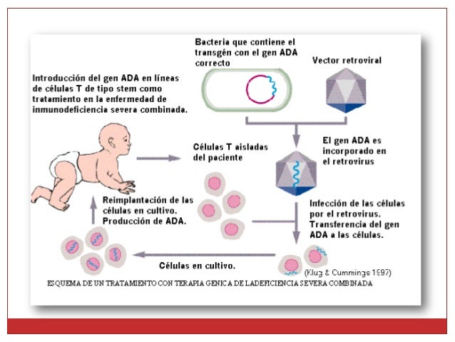 Terapia génica Terapia génica
