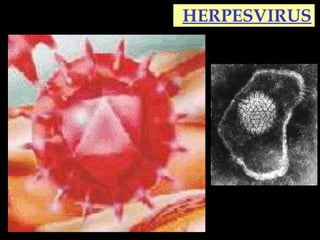 HERPESVIRUS
 