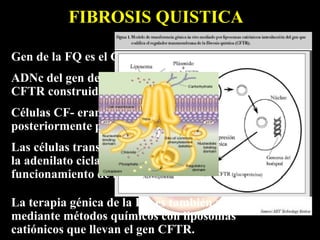FIBROSIS QUISTICA

Gen de la FQ es el CF
ADNc del gen de la conductancia transmembrana
CFTR construido y clonado en vector retroviral.
Células CF- eran infectadas y seleccionadas
posteriormente por un gen de resistencia.
Las células transfectadas adicionando estimulador de
la adenilato ciclasa expresaban el gen, detectándose
funcionamiento de los canales de Cloro

La terapia génica de la FQ es también realizada
mediante métodos químicos con liposomas
catiónicos que llevan el gen CFTR.
 
