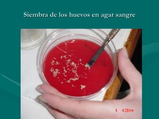 Siembra de los huevos en agar sangre 