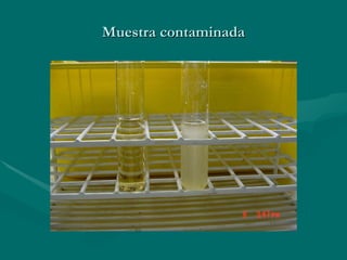 Muestra contaminada 