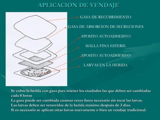 GASA DE RECUBRIMIENTO GASA DE ABSORCION DE SECRECIONES APOSITO AUTOADHESIVO MALLA FINA ESTERIL APOSITO AUTOADHESIVO LARVAS EN LA HERIDA APLICACION DE VENDAJE Se cubre la herida con gasa para retener los exudados las que deben ser cambiadas cada 8 horas La gasa puede ser cambiada cuantas veces fuera necesario sin tocar las larvas. Las larvas deben ser removidas de la herida máximo después de 3 días. Si es necesario se aplican otras larvas nuevamente o bien un vendaje tradicional. 