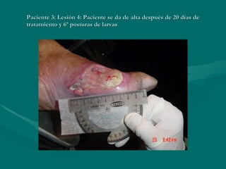 Paciente 3: Lesión 4: Paciente se da de alta después de 20 días de tratamiento y 6ª posturas de larvas 