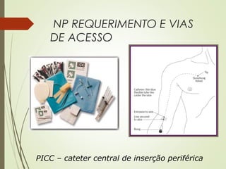 NP REQUERIMENTO E VIAS
DE ACESSO
PICC – cateter central de inserção periférica
 
