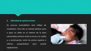 3. Dificultad de apertura bucal.
Se procura insensibilizar este reflejo de
mordedura. Para ello se intenta deslizar poco
a poco un dedo en el interior de la boca
colocándolo primero entre la encía y la mejilla
y, a continuación, entre las encías superior e
inferior, preparándose para sacarlo
rápidamente.
 