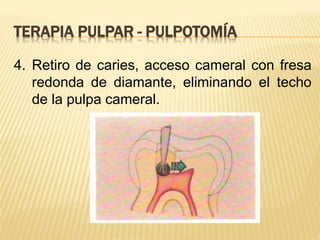 4. Retiro de caries, acceso cameral con fresa
redonda de diamante, eliminando el techo
de la pulpa cameral.
TERAPIA PULPAR - PULPOTOMÍA
 