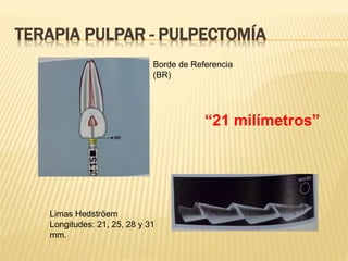 Limas Hedströem
Longitudes: 21, 25, 28 y 31
mm.
Borde de Referencia
(BR)
“21 milímetros”
TERAPIA PULPAR - PULPECTOMÍA
 