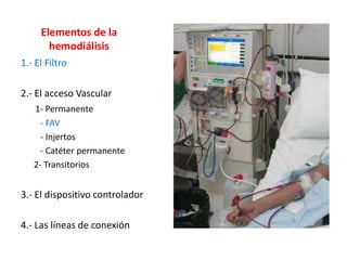 Elementos de la
hemodiálisis
1.- El Filtro
2.- El acceso Vascular
1- Permanente
- FAV
- Injertos
- Catéter permanente
2- Transitorios
3.- El dispositivo controlador
4.- Las líneas de conexión
 