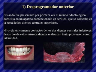 1) Desprogramador anterior
•Cuando fue presentado por primera vez al mundo odontológico
consistía en un aparato confeccionado en acrílico, que se colocaba en
la zona de los dientes centrales superiores.

•Proveía únicamente contactos de los dos dientes centrales inferiores,
desde donde estos mismos dientes realizaban tanto protrusión como
lateralidad.
 