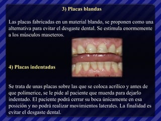 3) Placas blandas

Las placas fabricadas en un material blando, se proponen como una
alternativa para evitar el desgaste dental. Se estimula enormemente
a los músculos maseteros.




4) Placas indentadas


Se trata de unas placas sobre las que se coloca acrílico y antes de
que polimerice, se le pide al paciente que muerda para dejarlo
indentado. El paciente podrá cerrar su boca únicamente en esa
posición y no podrá realizar movimientos laterales. La finalidad es
evitar el desgaste dental.
 